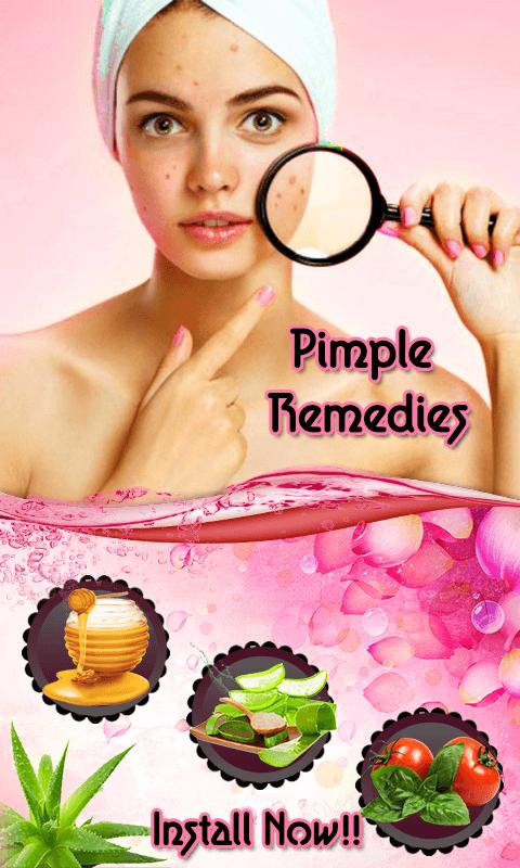 Pimple Remedies