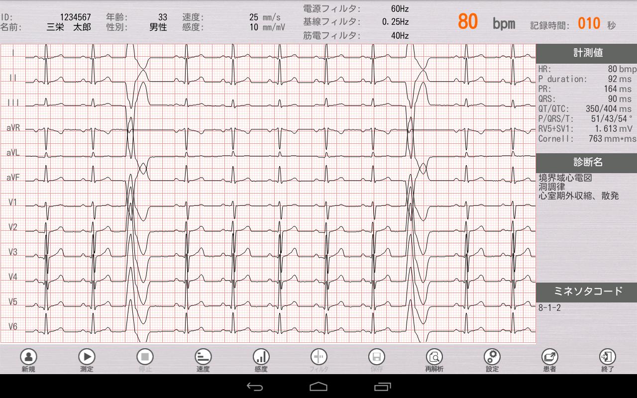 Tablet ECG